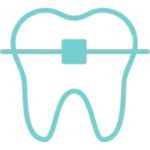 braces t