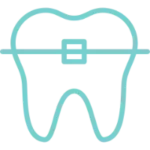 clear braces t