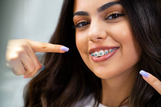 a woman with braces pointing to her teeth while smiling