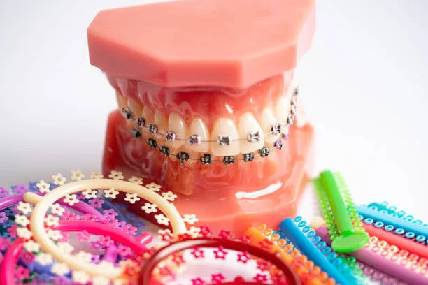 a teeth model with braces, surrounded by a variety of colorful bands